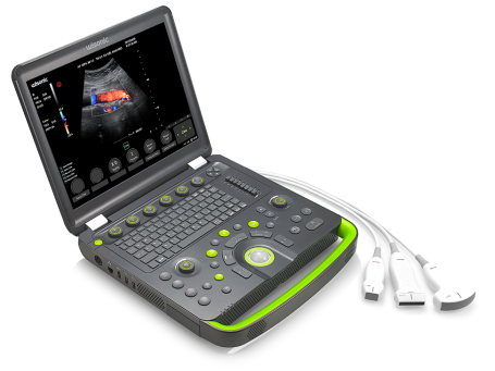 Laptop Ultrasound Scanner