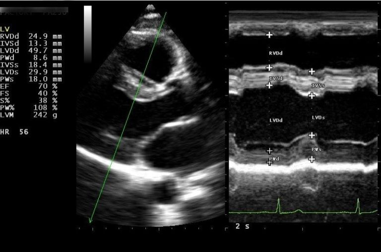 M Mode ultrasound