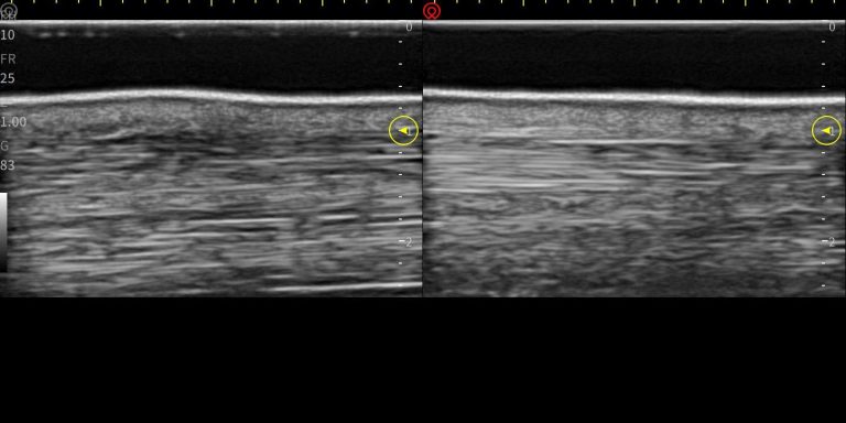 B/B mode image